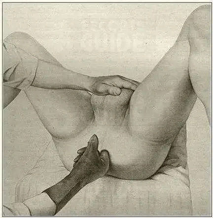 PROSTATE MASSAGE.